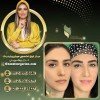 میکروبلیدینگ با غزل زرگریان
