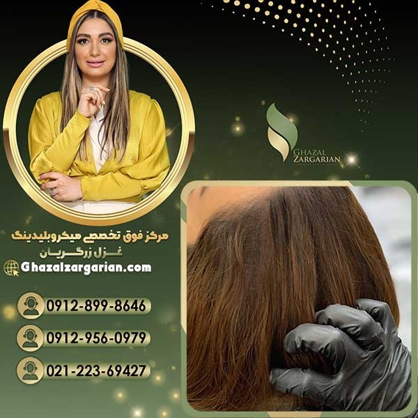 هاشور اسکالپ سر با بهترین کیفیت