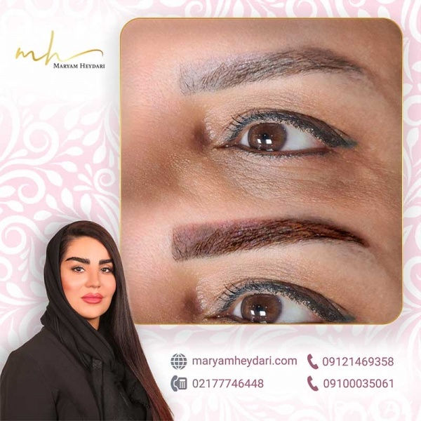 مرکز تخصصی پاک کردن تاتو ابرو با مریم حیدری