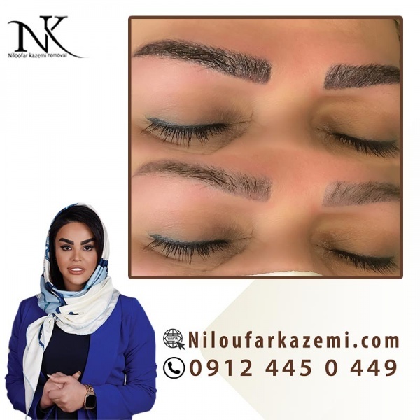 نیلوفر کاظمی متخصص و مدرس ریموو تاتو