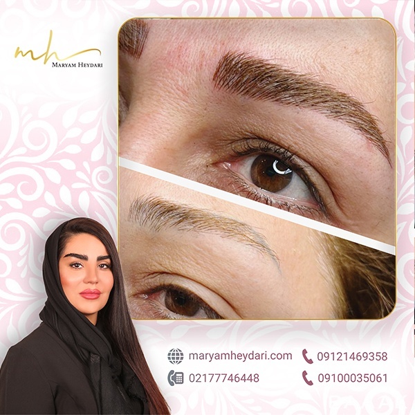 میکروبلیدینگ ابرو حرفه ای با قرینه سازی فوق العاده