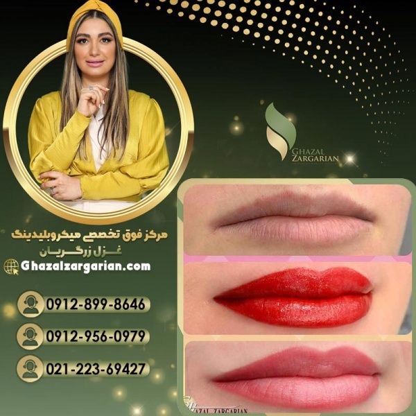 ریموو تاتو لب به بهترین شکل ممکن