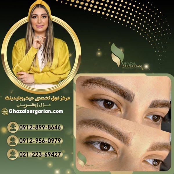 ریموو تاتو ابرو در مرکز تخصصی غزل زرگریان