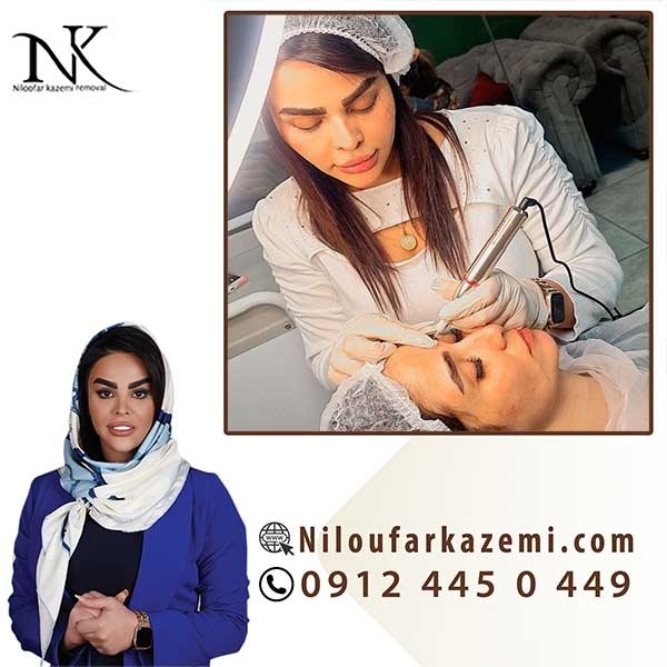آموزش ریموو تاتو بدون درد در بهترین مرکز ریموو