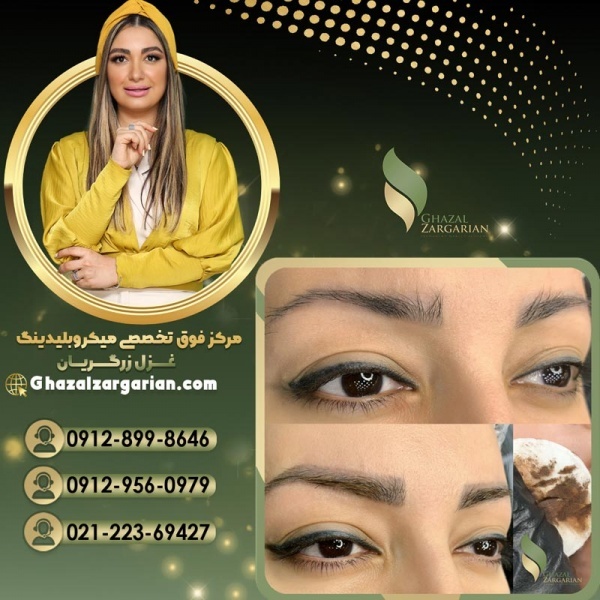پاک کردن میکروبلیدینگ ابرو با غزل زرگریان