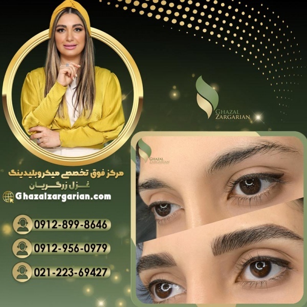بلید کرکی مویی با غزل زرگریان