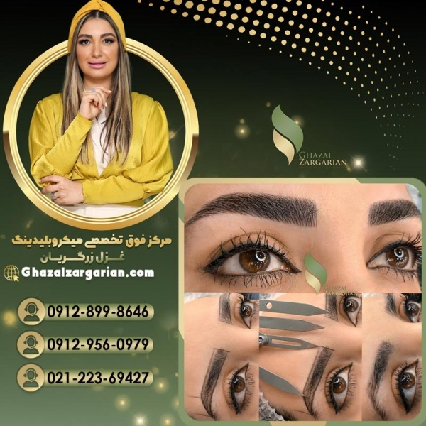 لمینت ابرو با روش بدون عوارض