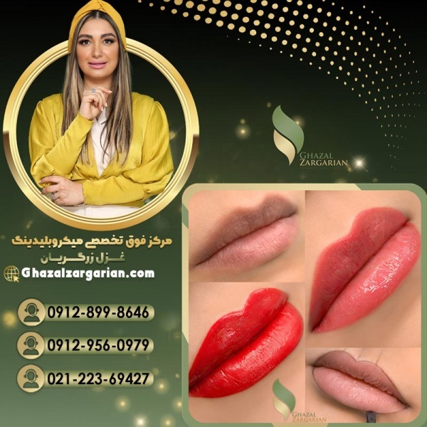 قیمت رژلب دائم در مرکز تخصصی غزل زرگریان