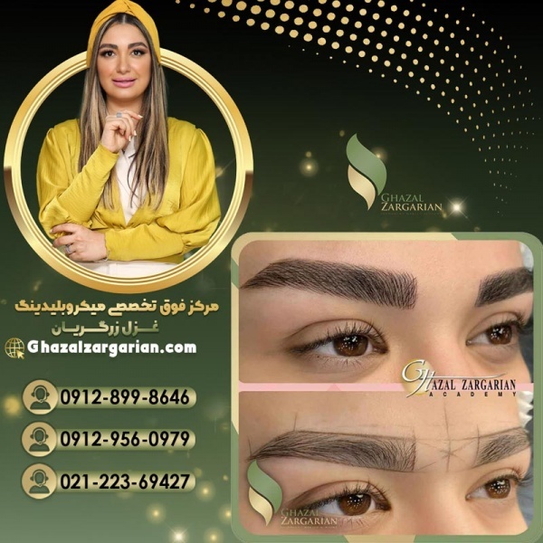 قیمت فیبروز ابرو در مرکز تخصصی غزل زرگریان
