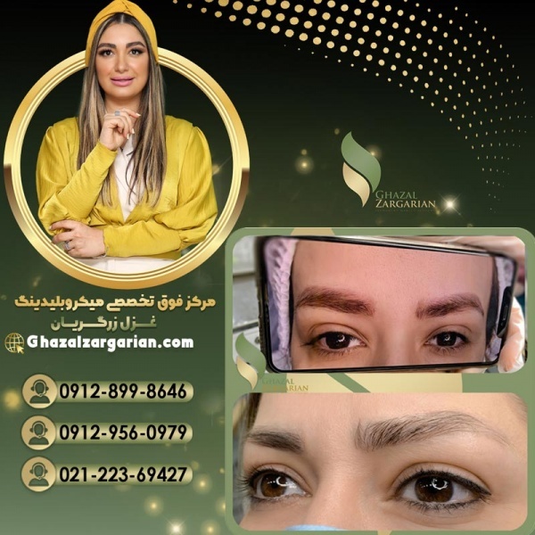 پاک کردن تاتو با مواد درمرکز غزل زرگریان