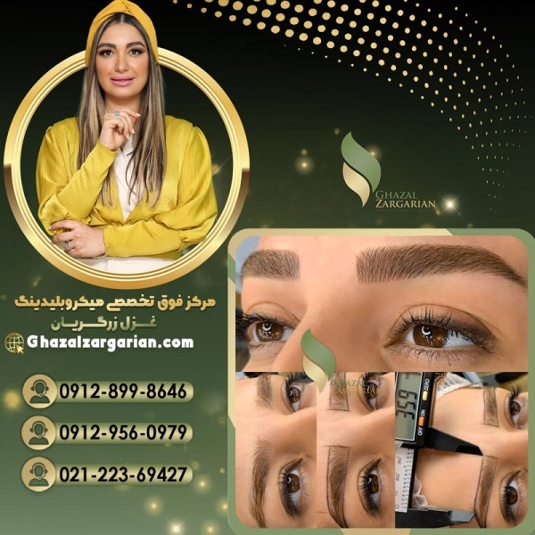 فیبروز ابرو در مرکزتخصصی غزل زرگریان