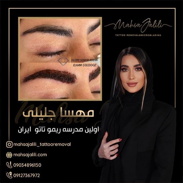 آموزش ریموو و پاک کردن تاتو مشکی 09127367972